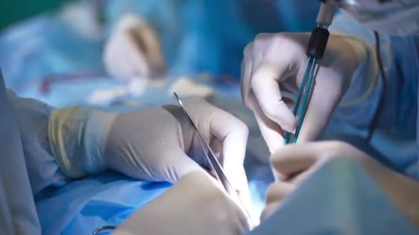 医生手中有各种各样的操作干预工具 外科医生在工作中使用钳 靠近点模糊的背景 — 图库视频影像