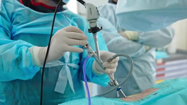 Χρήση Τεχνολογικού Ιατρικού Μέσου Κατά Λειτουργία Χέρια Του Χειρουργού Κρατούν — Αρχείο Βίντεο
