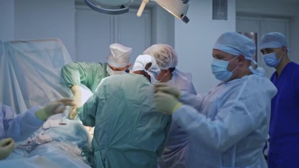 Duży Zespół Chirurgów Tłoczył Się Nad Operowanym Pacjentem Mężczyzna Lekarze — Wideo stockowe