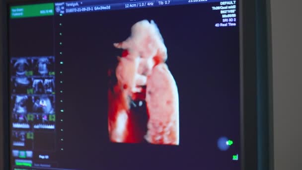 Appareils Ultrasons Travail Écran Montrant Organe Mouvement Lors Contrôle Par — Video