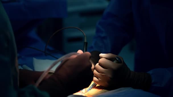 Sala Operações Escura Com Local Cirurgia Destacado Médicos Usando Ferramentas — Vídeo de Stock
