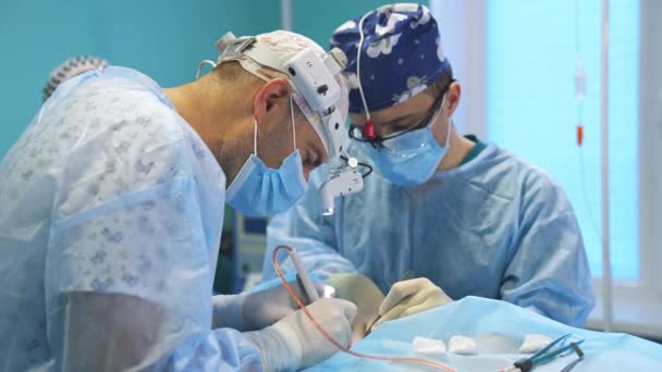 Kirurger Som Har Glasögon Huvudet Och Opererar Patient Läkare Flyttar — Stockvideo