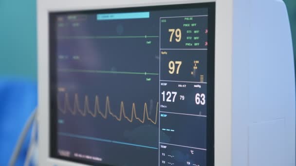 Różne Parametry Życiowe Pacjenta Pokazane Ekranie Sprzętu Sali Operacyjnej Zamknij — Wideo stockowe