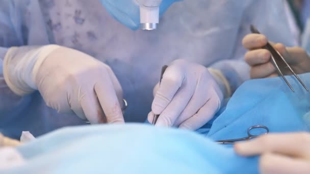 外科医生戴着手套的手在动手术 医生处理操作病人的金属仪器 靠近点 — 图库视频影像