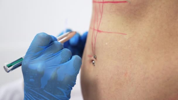 Rysunek Czerwonych Linii Długopisem Kobiecym Brzuchu Przekłuty Brzuch Przygotowywany Operacji — Wideo stockowe