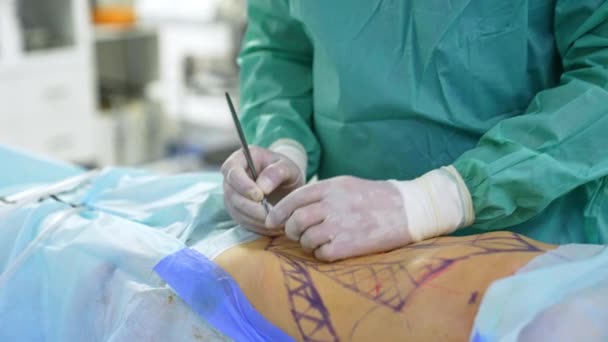 Handschuhhände Des Chirurgen Mit Skalpell Kunststoffspezialist Schneidet Patientin Einen Kleinen — Stockvideo