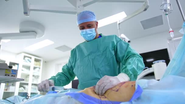 Kirurg Utför Buken Fettsugning Moderna Sjukhus Läkaren Stack Stora Sprutor — Stockvideo