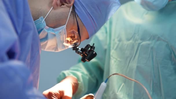 Główny Chirurg Masce Czapce Okularach Przyrządów Pochylił Głowę Nad Pacjentem — Wideo stockowe