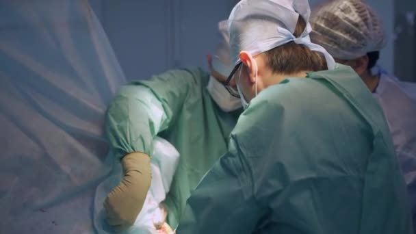 Kirurger Som Samarbetar Och Hjälper Varandra Operation Team Medverkande Läkare — Stockvideo