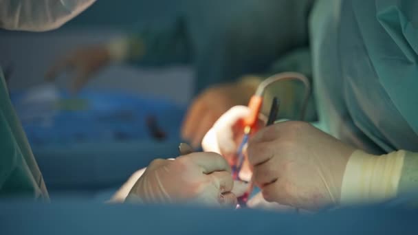 金属製の道具を適用する外科医の手の手の2組 バックドロップのアシスタント バックグラウンド — ストック動画
