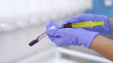 Test tüpünü şırıngadaki damar kanıyla dolduruyorum. Eldivenli eller analiz için kan örneği hazırlıyor. Kapat..