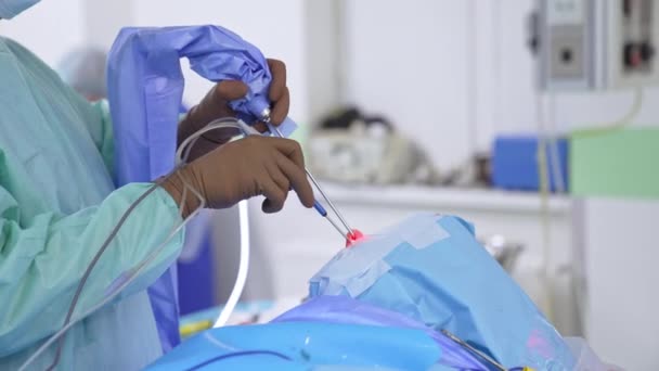 外科医生戴着手套的手把先进的仪器输送到病人的鼻子里 应用现代技术进行鼻腔手术 模糊的背景 — 图库视频影像