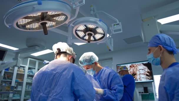 Equipe Masculina Cirurgião Que Está Sob Lâmpadas Grandes Sala Cirurgia — Vídeo de Stock