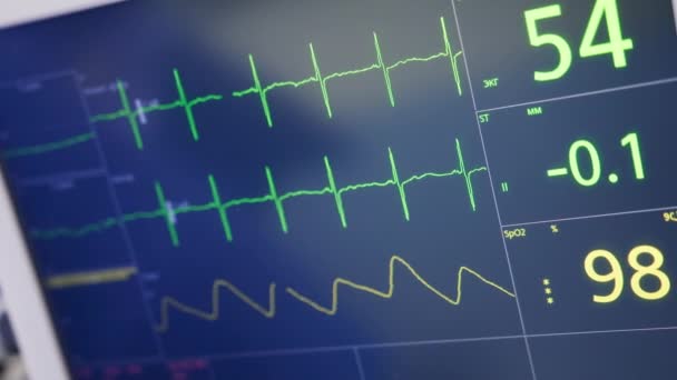 Hajlított Vonalak Futnak Sebészeti Berendezések Monitorján Közelről Műtét Alatt Álló — Stock videók