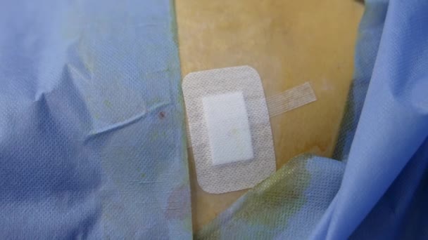 Hastanın Tarafındaki Kesiğe Yapıştırıcı Sıva Sürülmüş Kapatın Hasta Mavi Çarşaflarla — Stok video