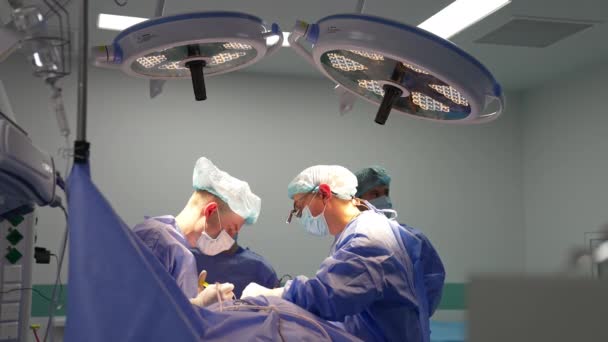 Equipe Cirurgiões Profissionais Que Conduz Operação Abaixo Grandes Lâmpadas Aproximar — Vídeo de Stock