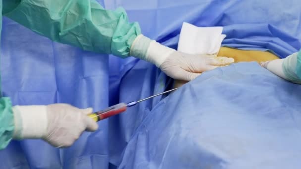 医生的手套手用大针把注射器插入病人的身体 靠近点现代诊所的干细胞操作 — 图库视频影像