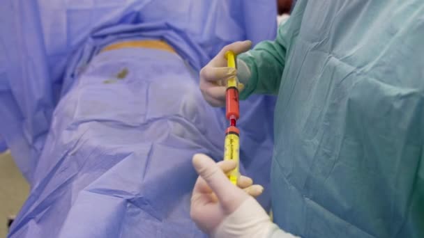 医師の手に2本のシリンジが入った ラテックス手袋の医師は 手術前に幹細胞を準備しています クローズアップ — ストック動画