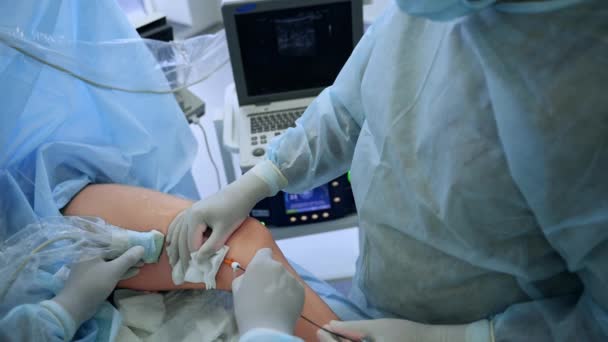 Εγχείρηση Στις Φλέβες Ενός Ασθενούς Γάντια Χέρια Των Γιατρών Εφαρμόζουν — Αρχείο Βίντεο