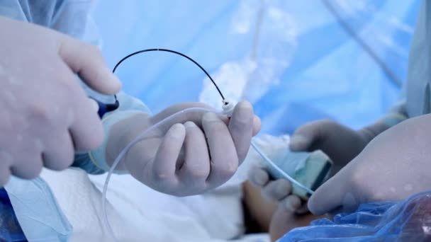男性は手のひらを握り 外科用具および装置を使用しました クローズアップ プロセスにおける血管操作 — ストック動画