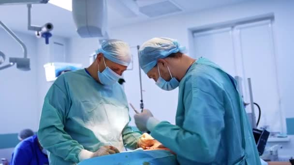 Fachkräfte Für Plastische Chirurgie Führen Bauchoperationen Durch Ärzte Nähen Den — Stockvideo