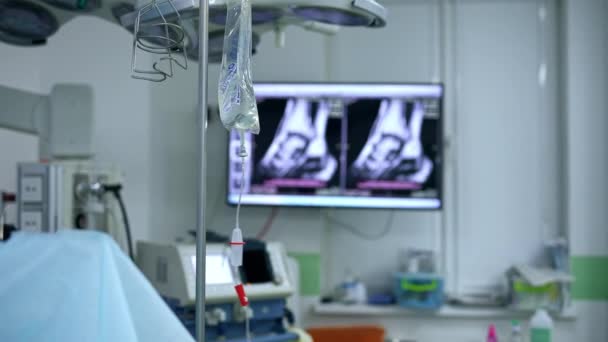 Підставка Краплями Лічильника Висить Махає Хірургічній Кімнаті Екран Двома Знімками — стокове відео
