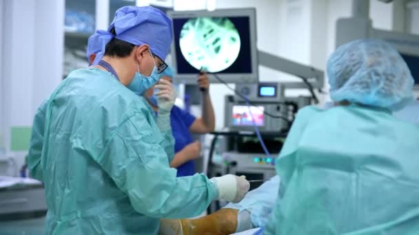 Чоловік Лікар Виконує Операцію Нозі Пацієнта Медсестра Передає Інструменти Головному — стокове відео