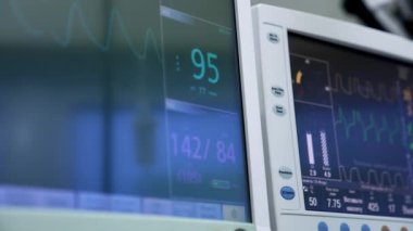 Ameliyat odasında çalışan yapay akciğer havalandırma sistemi monitörleri. Siyah ekranlar, prosedür altındaki hastanın yaşam eğrisi ve parametrelerini gösterir.