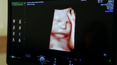 Elini kafasında tutan doğmamış bir bebek resmi. Ultrason makinesinde gebeliğin son evresinde çekilmiş şirin bir üç boyutlu fotoğraf. Kapat..