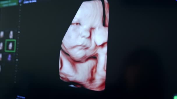 Słodki Prenatalny Obraz Nienarodzonego Dziecka Trzymającego Rękę Twarzy Zdjęcie Wewnątrzmaciczne — Wideo stockowe