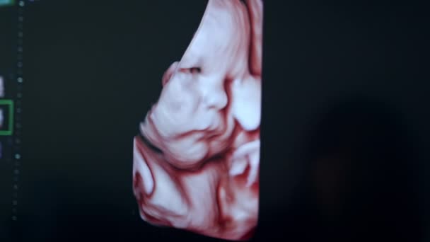 Obrázek Dítěte Obrazovce Ultrazvukového Zařízení Zavřít Černý Monitor Dítětem Břiše — Stock video
