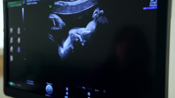 Ultradźwiękowy Obraz Dziecka Łonie Mamy Czarnym Ekranie Sprawdzanie Rozwoju Dziecka — Wideo stockowe