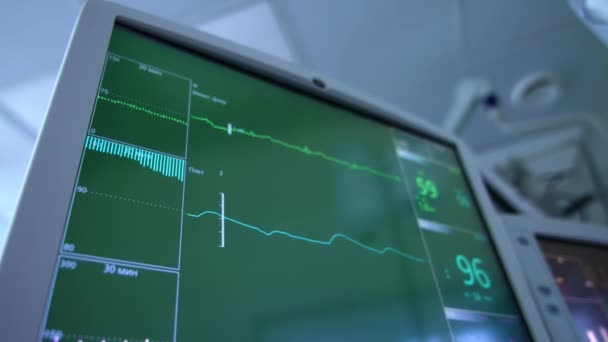 手術室の装置の緑色のスクリーンで走る2つの曲線 クローズアップ ローアングルビュー ブラーレッド バックドロップ — ストック動画