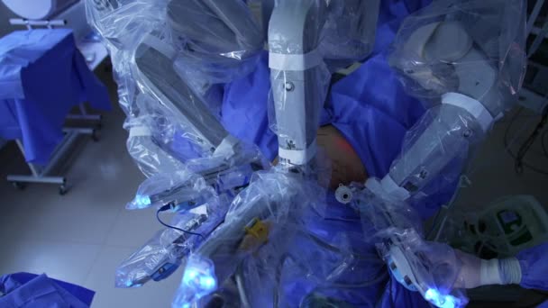 Paciente Submetido Cirurgia Laparoscópica Clínicas Modernas Braços Manipuladores Sistema Cirúrgico — Vídeo de Stock
