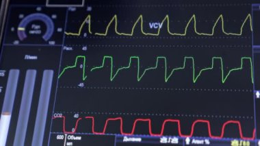 Siyah ekranda kıvrımlı kalp atış hızı çizgileri. Ameliyattaki bir hastanın yaşam parametreleri. Kapat..