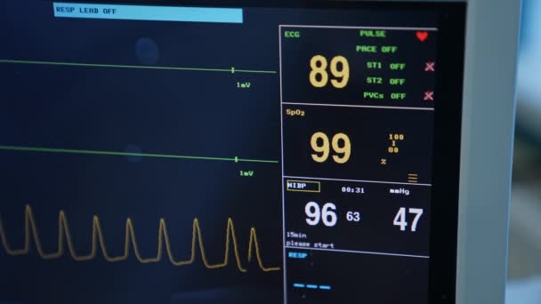 黒いスクリーンの脈拍そして心拍数変数 外科手術の下で患者の生命の徴候 クローズアップ — ストック動画