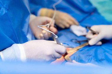 Hastane sağlık hizmetleri cihazı. Steril cerrahi tıbbi teknolojiler.