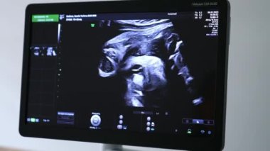 Hamile kadın kontrolü sırasında ultrason cihazının görüntüsü. Doğum öncesi bebek gelişimi için ultrason kontrolleri.