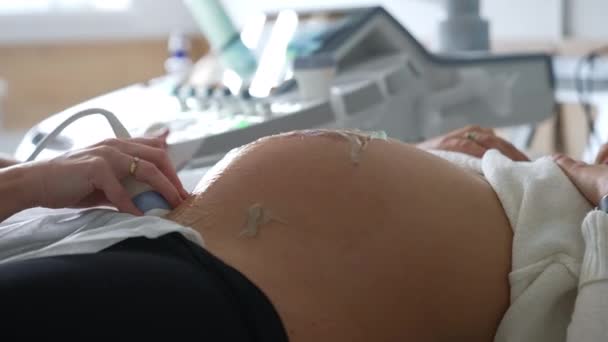 Schwangere Lassen Sich Ultraschall Untersuchen Die Hand Des Arztes Bewegt — Stockvideo