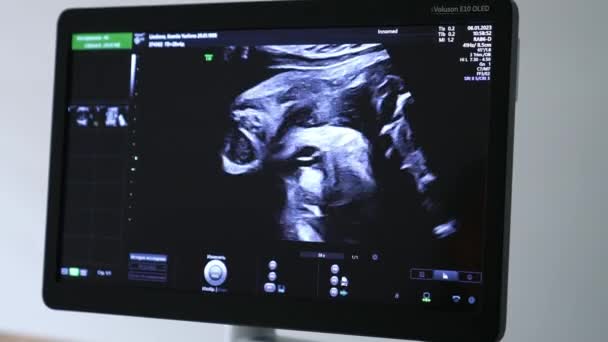 Skärm Ultraljudsmaskin Den Gravida Kvinnliga Kontrollen Sonogramdiagnostik För Prenatal Babyutveckling — Stockvideo