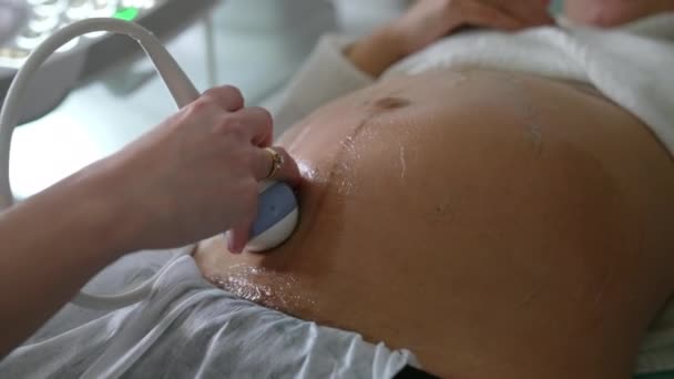 特別なゲルで覆われた妊婦の腹部 医師は患者の腹部によって超音波センサーを動かします クローズアップ — ストック動画