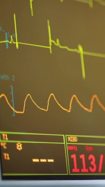 オペレーティングルームのEcgモニター 病院での外科手術中にモニターの画面上のカラフルな波 クローズアップ バーティカルビデオ — ストック動画