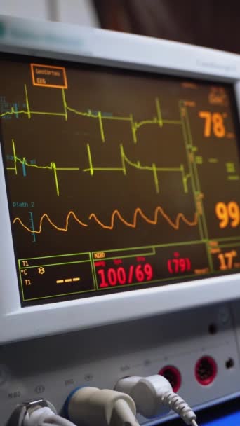 手术室的心率监测器 医院监视器上病人的生命体征 手术过程中 病人的心跳在屏幕上出现 垂直录像 — 图库视频影像