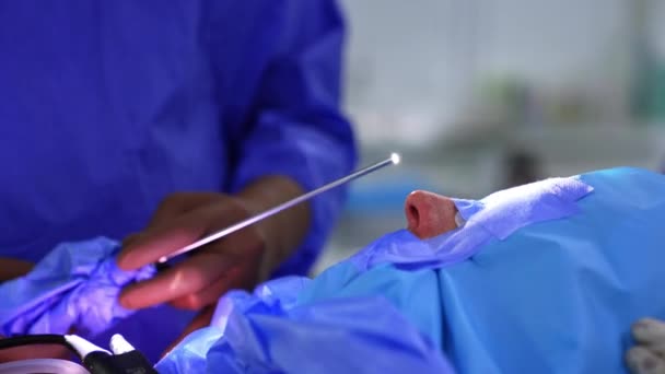 Ręce Chirurga Trzymające Instrument Światłem Górze Doktor Jest Gotowy Użycia — Wideo stockowe