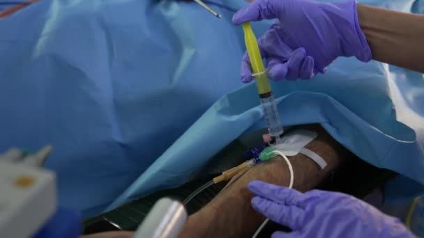 Dłonie Medyka Lateksowych Rękawiczkach Wkładają Leki Cewnika Przymocowanego Ręki Pacjenta — Wideo stockowe