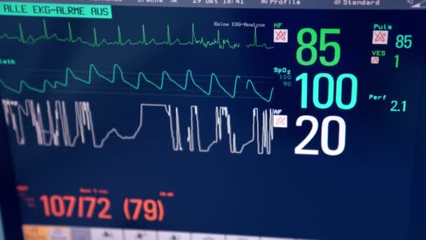 Screen Medicinsk Utrustning Som Visar Livslängdsparametrar För Patient Operation Närbild — Stockvideo