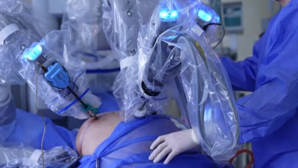 患者の腹部に挿入されたロボットアームは手術でゆっくりと動きます 認識されていない薬は 患者の手を握る近くに立っています — ストック動画