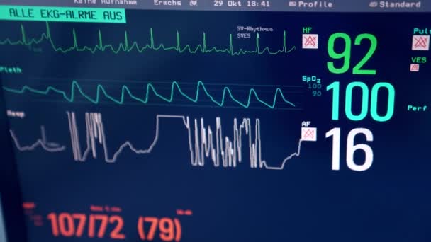 Rythme Cardiaque Autres Paramètres Patient Écran Ventilateur Pulmonaire Ferme Image — Video