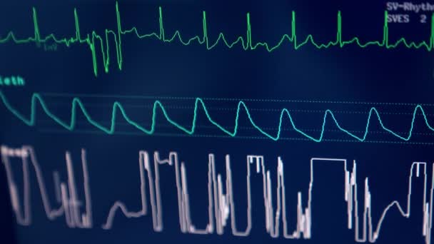 蓝色屏幕上运行的生命符号曲线 靠近点手术室的手术器械 — 图库视频影像