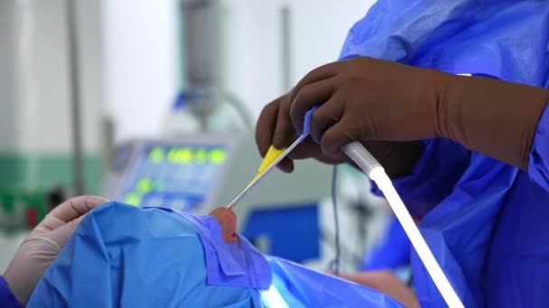Neznámý Otolaryngologický Chirurg Používá Nástroje Nose Pacienta Doktor Používá Nástroje — Stock video